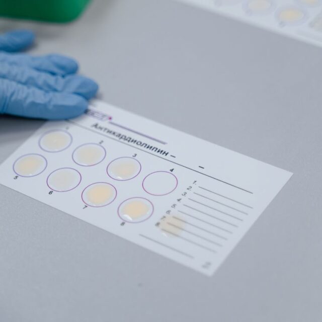 SNPA 34/2021: incertezza target, incertezza del laboratorio e criteri di congruenza
